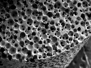 Pentingkah ceramic biomaterial dalam kehidupan kita?